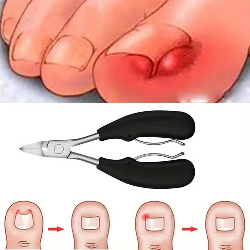 ✨ 4-in-1 Ingrown Toenail Clipper Set – Precision Care for Thick, Tough Nails! ✂️
